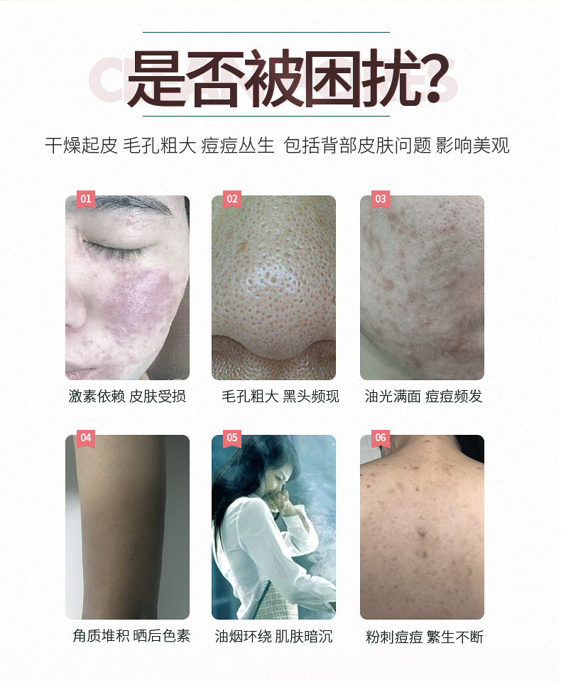 凯发网站 深层洁净清洁霜